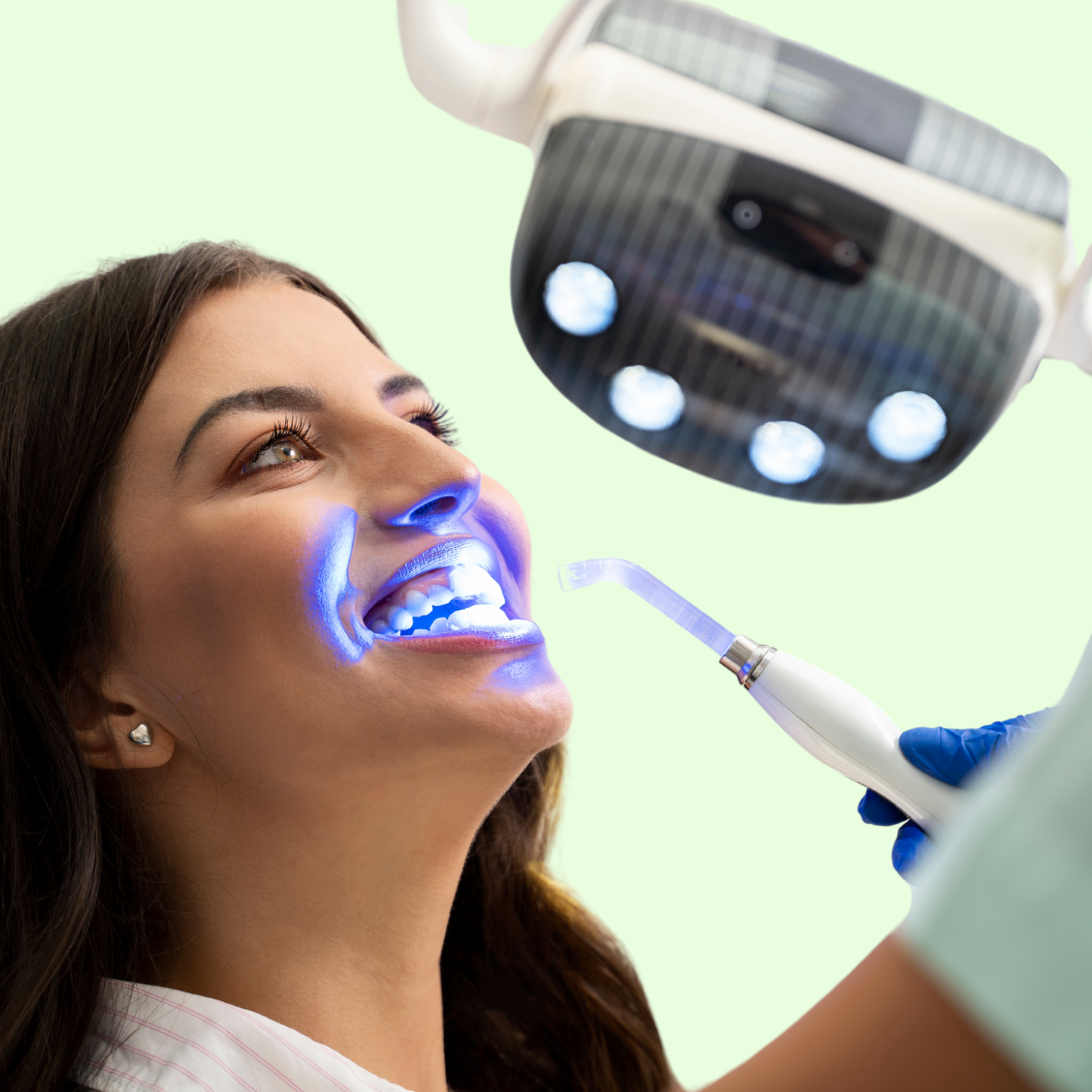 White Wave: Teeth Whitening Kit